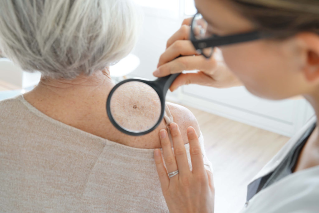 Mole & Skin Lesion Removal Kansas City