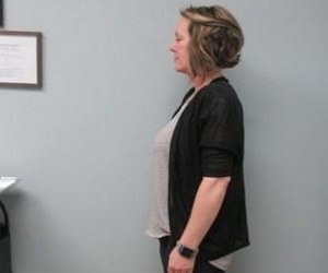 Medical_Weightloss_After_1