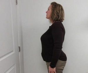 Medical_Weightloss_Before_1