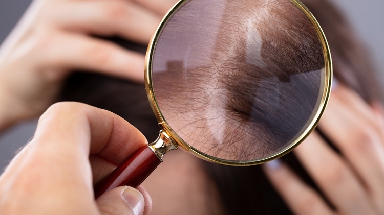 Hair loss treatmentHair loss treatment Kansas City Kansas City,